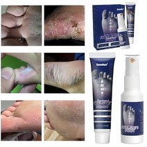 발톱 무좀약 연고 목초액 무좀치료 스프레이 발냄새 제거 가려움증 연고, (20g+60mL), 5개