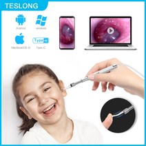 스마트귀이개 내시경귀이개 보이는귀이개 귀후비개 카메라귀이개 TESLONG 3 in 1 귀 내시경 카메라 4.3mm 청소 도구 HD 비주얼 이어 스푼 이어픽 TYPE-C 안드로이드, 한개옵션0