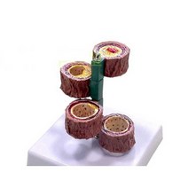 인체 혈관 모형 아픈 형관 데모 모형 병리학 동맥 경화증, 4척의 선박