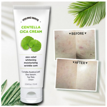 영웨이즈 센텔라 시카 크림 / 티트리 / 병풀 / 봉독 / 어성초 여드름, 3개, 75ml