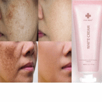 제이블릭 반점제거에센스 점제거 기미 반점 주근깨 천연 사마귀 여드름 항산화 크림페이퍼팩 세럼 앰플 얼굴반점제거 기미반점제거 기미주근깨반점제거 스팟점제거에센스 기미 주근깨 제거, 피부톤개선 반점제거 브라이트 앰플, 1개