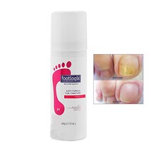 Footlogix 풋로직스 안티펑거 스프레이 50ml, 1개, 1