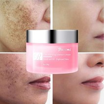 효과적인 미백 크림 주근깨 크림 다크 스팟 제거 여드름 흉터 멜라닌 색소 침착 기미 노화 방지 피부를 밝게, 01. Rose Cream