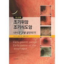 100 증례 조기위암 조기식도암:내시경 감별 달인되기, 요시나가 시게타카 저/김광하 역, 우리의학서적