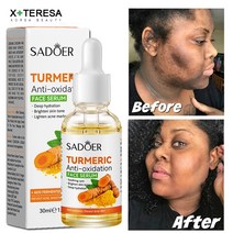 심황 세럼 페이셜 화이트닝 다크 스팟 리무버 여드름 흉터 밝은 피부 안티 에이징 페이스 오일 거칠기 개선 스킨 케어