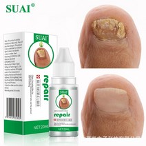 발바닥 각화형 무좀 발톱무좀 치료 약 연고 발냄새없애는법, 3개
