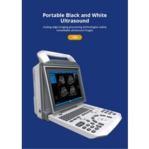 휴대용 3차원 측정기 휴대용 퍼스널 컴퓨터 PBWU50 조정가능한 각 초음파 3d 스캐너 기계, 한개옵션0