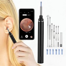 내시경 카메라 귀이개 귀후비개 귀청소 귓밥 제거기 귀지 청소기 LED 스마트VITCOCO 검이경 귀 왁스 제거, 01 Black