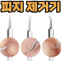 코피지 제거기 얼굴 압출기 블랙헤드 압출 뽑기, 1개, 일자형
