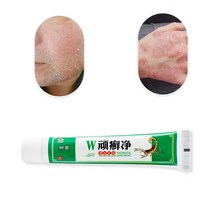 kemisi 습진 스킨 러쉬 크림 피부염 습진 항균 연고 바디 초본 항균 크림, 2개