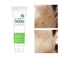 1+1 에스알픽 트러블 자국 각질 모공수축 티트리폭탄 폼클렌징 120ml, 10세트
