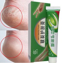 풋크림 발보습제중국어 허벌 25g 오일 안티 건조 균열 발 크림 뒤꿈치 금이 복구 제거 죽은 피부 손 피트, 한개옵션1, 한개옵션0