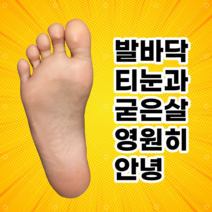 CB40 티눈깔창 발바닥 굳은살 제거, 225~230, 블루 혹은 그레이 랜덤