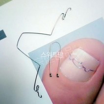 내성발톱 교정기 셀프교정 2개 1세트 파고드는발톱 말린발톱 자가교정 엄지발톱 내성발톱와이어 와이어