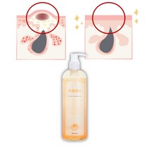 피지녹이는제품 피지제거액 모공각화증 스크럽 각질용해제 피지 녹이는오일 알갱이 귀블랙헤드, 1개