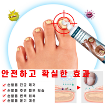 문제성 손 발톱 무좀 치료 두꺼워짐 곰팡이 리페어 연고, 3개, 30ml