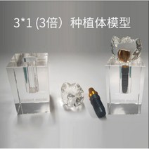 치아모형 인체모형도 치과기구 실리콘몰드 인체모형 양치교구 재료상, 3x 크리스탈 임플란트 모델