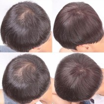 기타 남자 남성 정수리 가발 인모 맞춤 부분 원형 O형, 상세페이지 참조, 상세페이지 참조, 상세페이지 참조