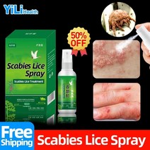 옴 항균 스프레이 머릿니 제거 스킨 케어 액체 치료 진드기 건선 anti-pruritus, 제비꽃