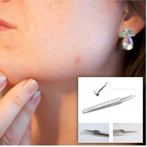 뾰루지 짜는법 좁쌀여드름 없애기 블랙헤드 없애는법 셀프 스킨플래닝 피지 불리기 초등학생