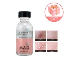 매드스킨케어 아크네 드라잉 로션 30ml+긴면봉 화농성 좁쌀 여드름 뾰루지 염증 트러블 가려움증 진정