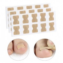 다파요 10P 20P 50P 엄지 내성발톱 교정테이프 관리 케어밴드 테이프 내성발톱테이프 내성발톱자가치료 내성발톱교정기, 2장(20P)