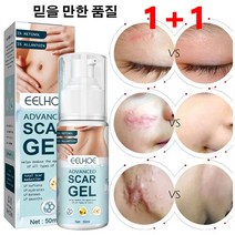 1+1흉터 제거 연고 50ml 흉터 개선 젤 오래된흉터제거연고 상처흉터연고 쌍꺼풀 흉터/제왕절개 흉터/수술 흉터 여드름 흉터/비후형 흉터/화상 흉터, 50ml*3