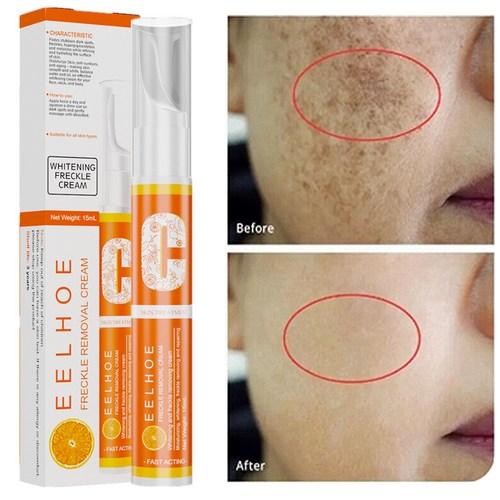 기미 제거 멜라논크림, 4개, 15ml