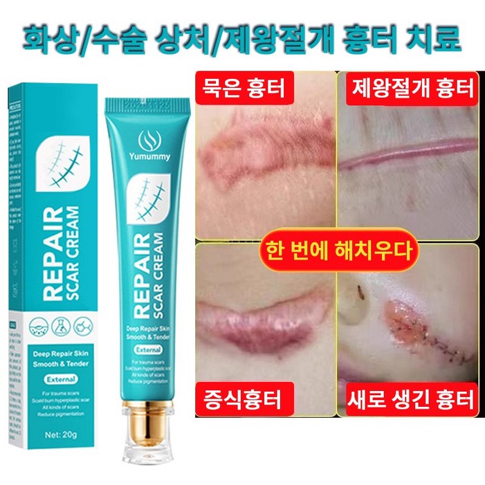 피부 관리 흉터 연고 화상 흉터 연고   화상연고
