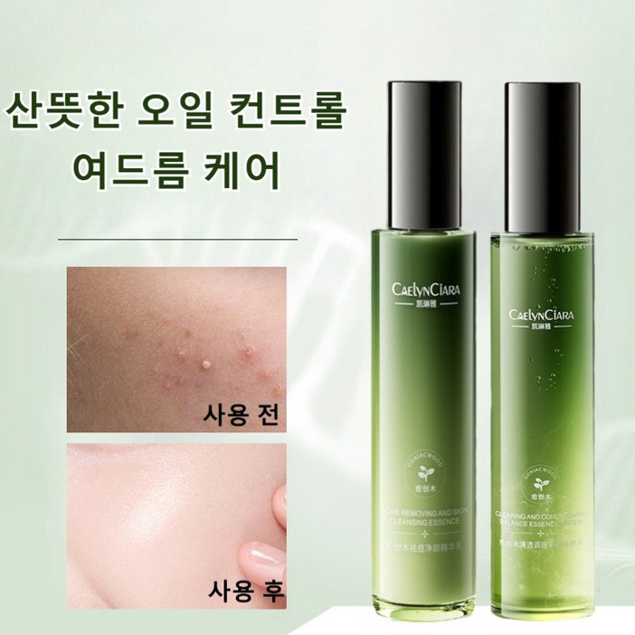 워터밸런스 스킨 로션 세트 여드름화장품 지성 피부 트러블 진정 스킨 화장품 여드름 진정 케어 토너115ml+ 로션 115ml 세트