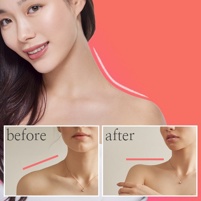 PPC 괄사크림 괄사앤 승모케어크림 승모근 일자어깨 괄사엔, 120g, 3개