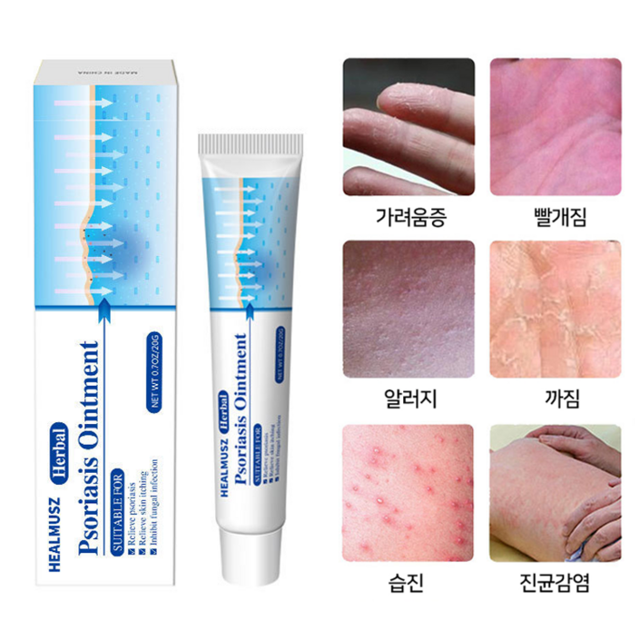 HEALMUSZ 촉성피부염 알러지 알레르기 피부연고 아토피상처 소양증 대상포진 백선연고 습진 A04