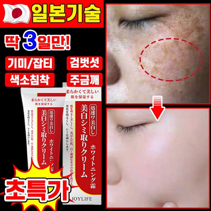 국내배송 일본 11122 기미 잡티 주근깨 검버섯 제거 크림 멜라논크림 멜라토닝 들깨기미 크림 얼굴 색소침착 화이트닝 기미케어 미백 포장증정