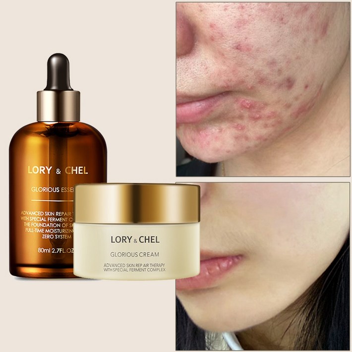 로리앤첼 글로리어스 수분 보습 크림  에센스 세트, 1세트