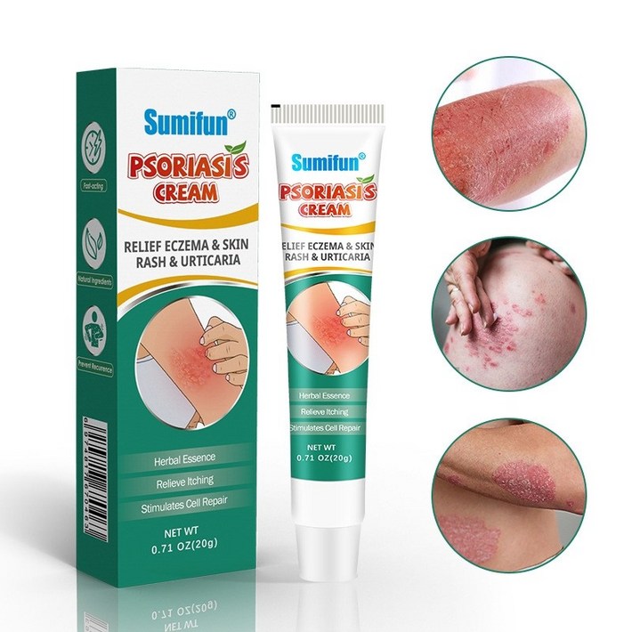 즉각케어피부 곰팡이균 연고 건선 가려움증 습진연고 피부 가려움증 20g  S29