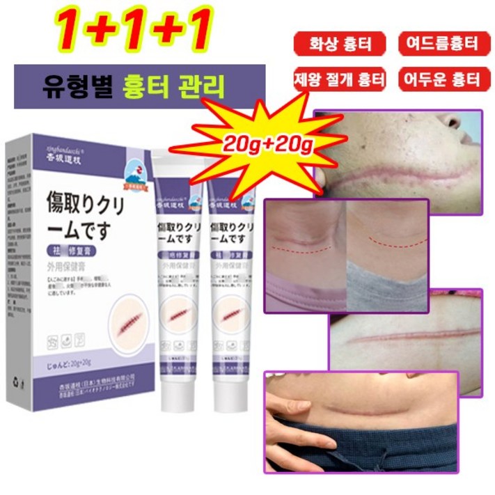 100제거당일배송 흉터제거 상처흉터 여드름 민감한 피부를 수술 화상 제왕절개 수술흉터