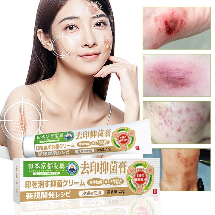 KORE LAN 흉터 제거 크림  수술  화상  제왕절개 여드름 흉터 항진균 피부 가려움증 흉터지우겔