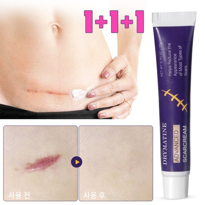 당일배송 DRYMATINE 흉터연고 흉터제거연고 재생크림 상처흉터연고 여드름흉터 수술흉터 화상물집 흉터제거연고 재생크림 화상연고 흉터연고 연고 상처연고후시딘 상처연고 마일드랩, 3개, 20ml