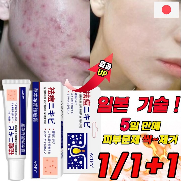 국내배송 여드름 연고 흉터 치료 제거 리페어 연고 문제피부 자국 모공 진정 피지케어 크림